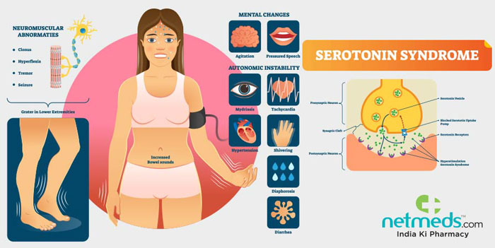 سندروم هورمون سروتونین