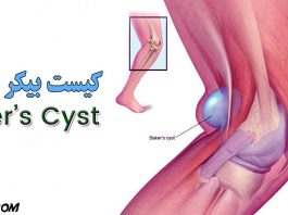 کیست بیکر چیست